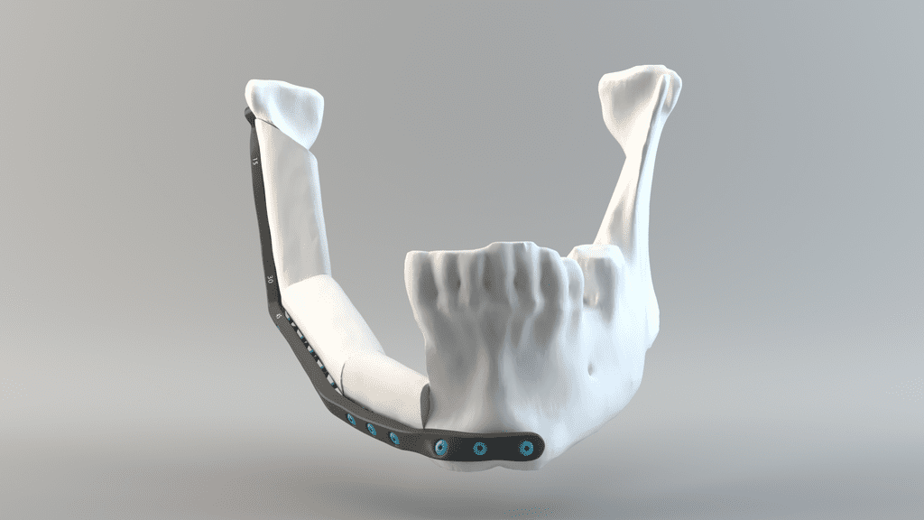 imageCRIQ01 credit Quentin Schneider 3D modeling lab CHU de Quebec Sept 2018