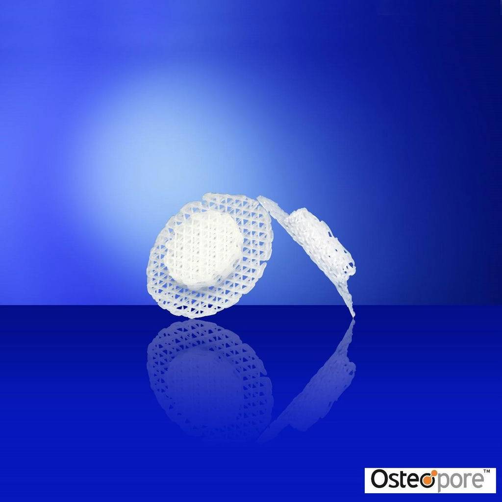 Osteoplug, a 3D printed bioresorbable implant used for neurosurgical burr holes