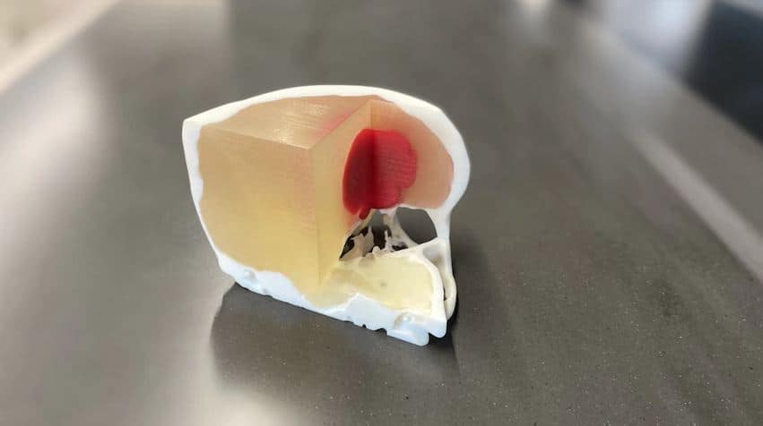 3D printed body parts