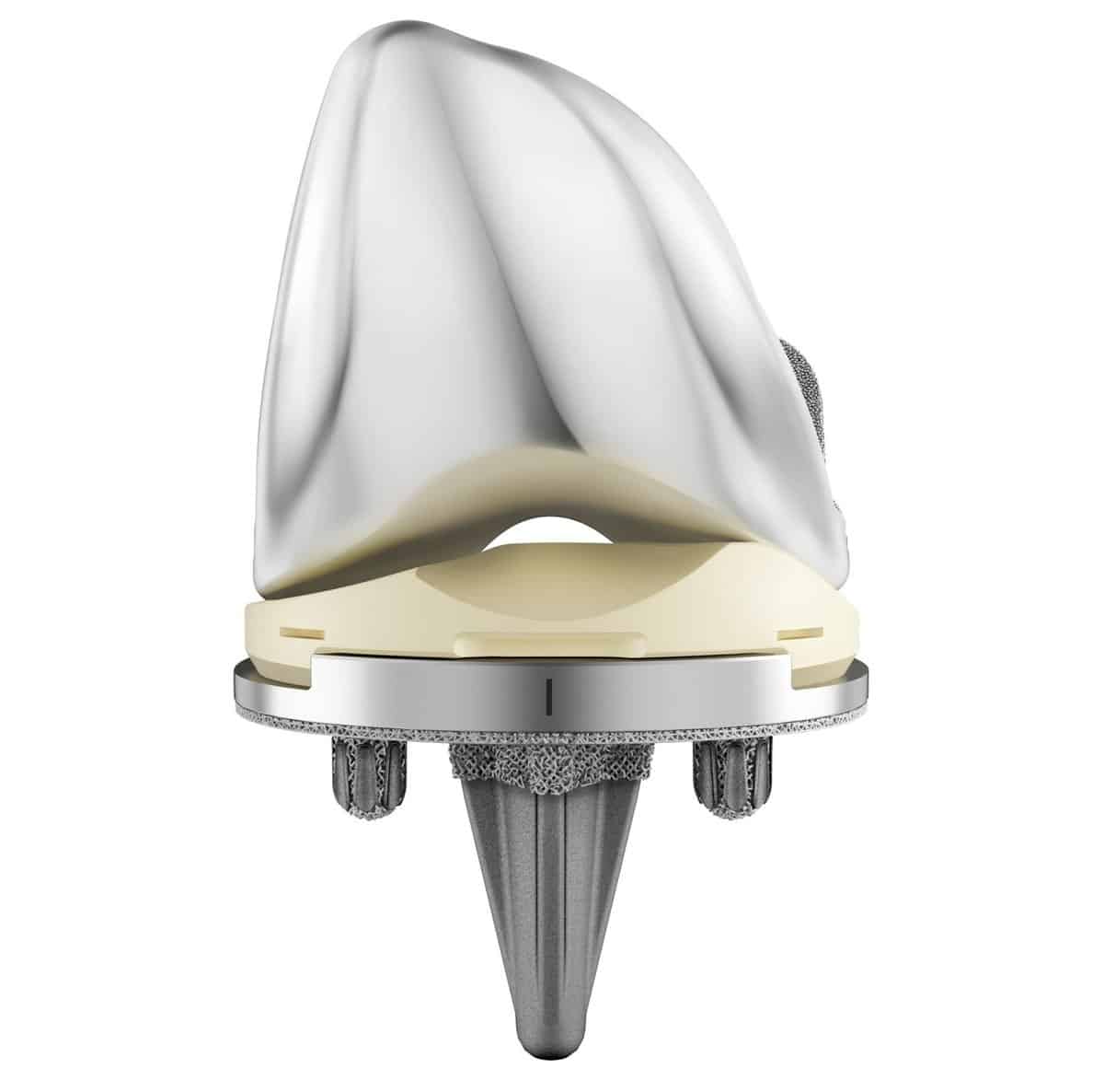 DePuy Synthes Knee Replacement