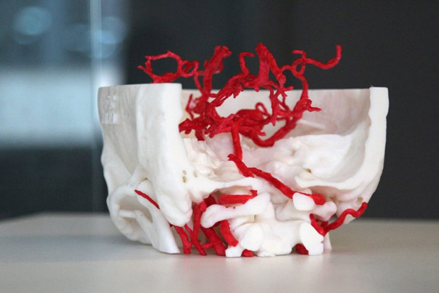 3D Printed Medical Model by
