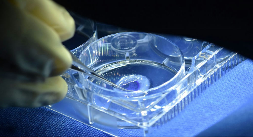 Research on 3D Printed Cornea in India