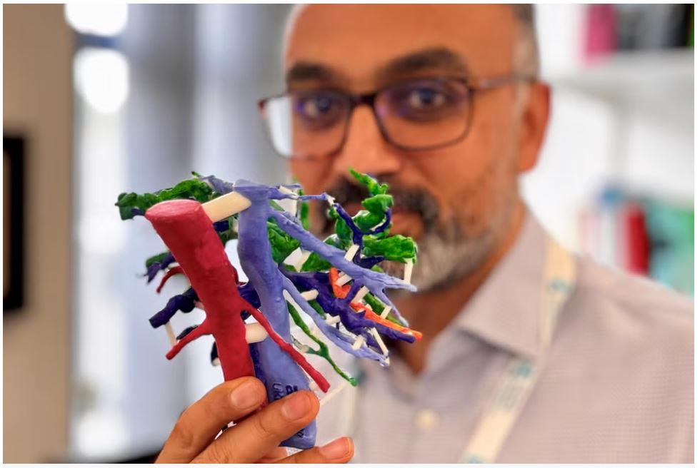 Mr Arjun Takhar a consultant hepatobiliary and pancreatic cancer surgeon at University Hospital Southampton and the 3D printed liver model PLANETS Cancer Charity PA Wire