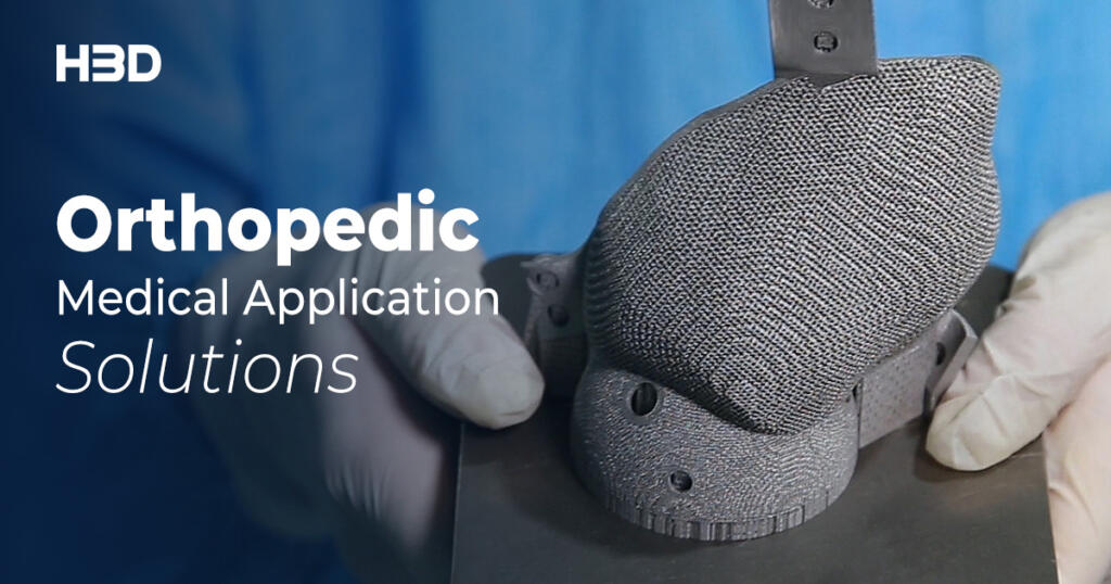 HBD Advances in Metal 3D Printing for Customized Orthopedic Implants